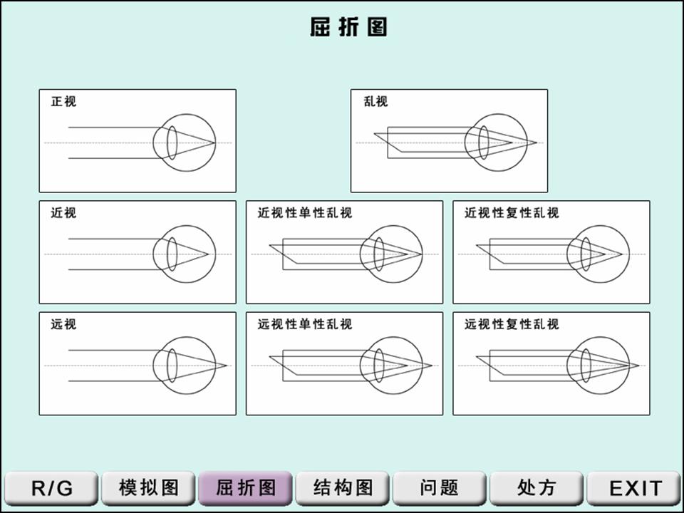 rt-5100电脑综合验光仪